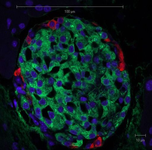 صورة للخلايا "بيطا" البنكرياسية المفرزة للأنسولين