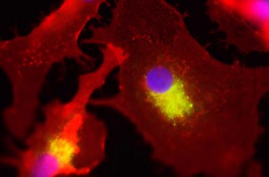 صورة لخلايا جدعية ملتفة حول خلايا سرطانية