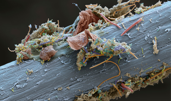 صورة مجهرية لخيط تنظيف الأسنان