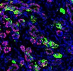 Zhu et al_Pancreatic beta cells